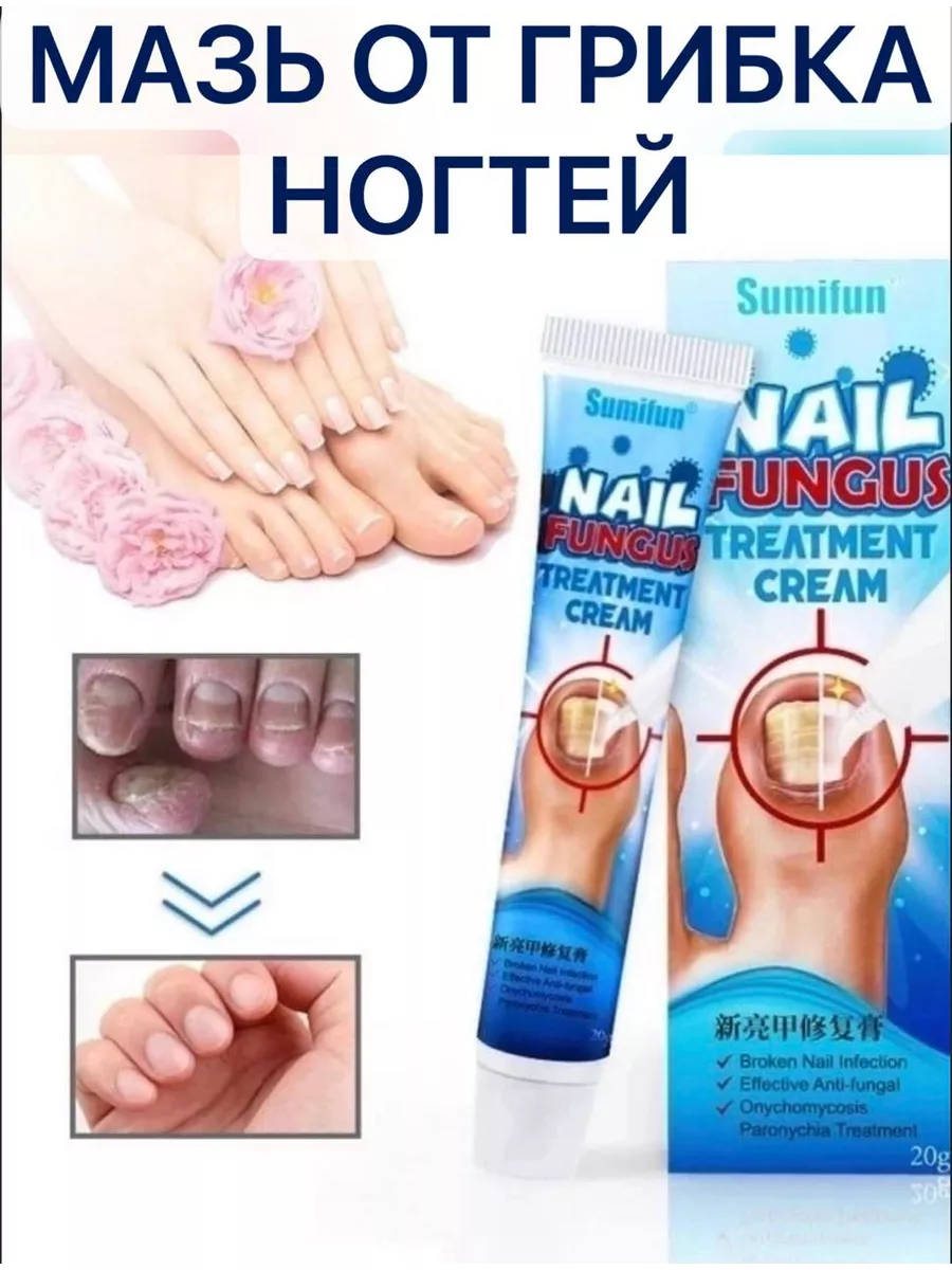 Средство от грибка ногтей Sumifun Nail Fungus Ointment Enuka купить по цене  180 ₽ в интернет-магазине Wildberries | 216669205