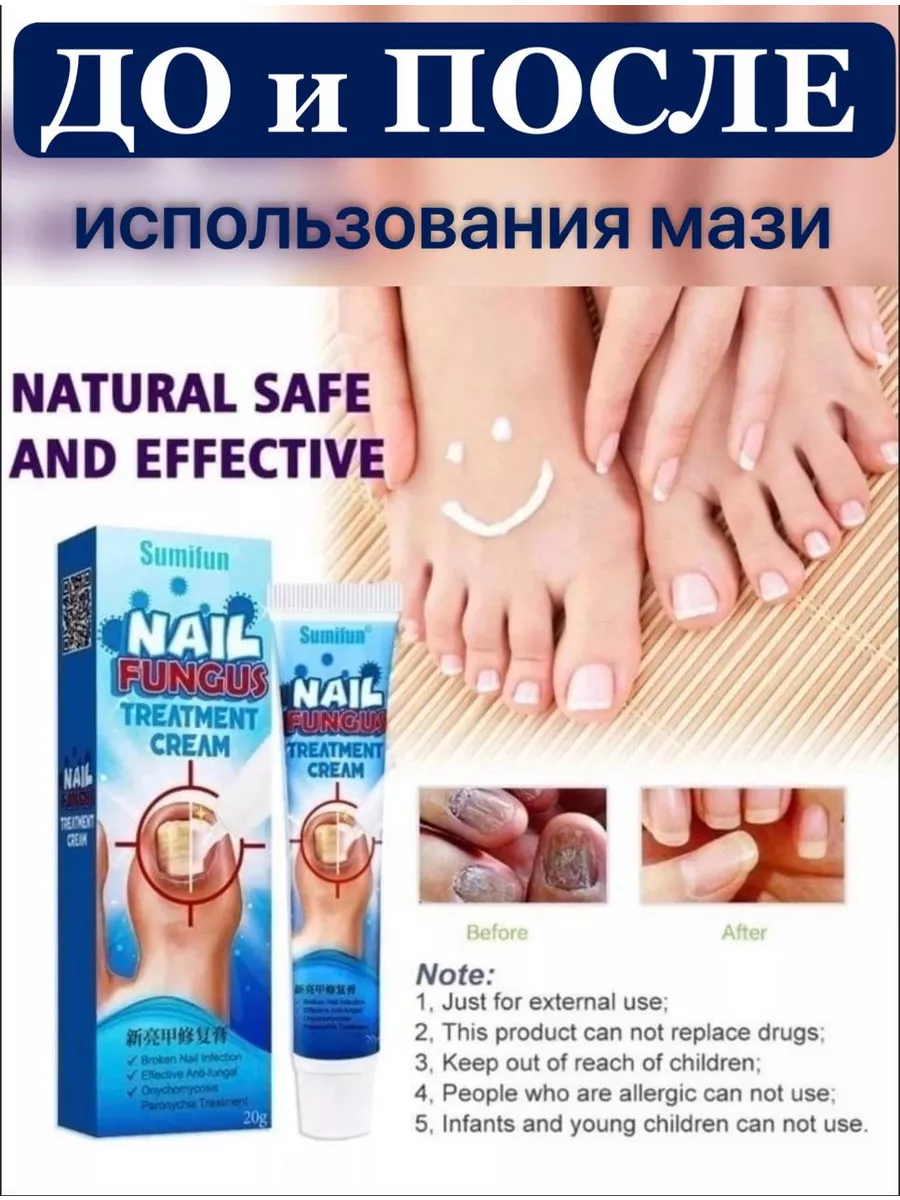 Средство от грибка ногтей Sumifun Nail Fungus Ointment Enuka купить по цене  180 ₽ в интернет-магазине Wildberries | 216669205