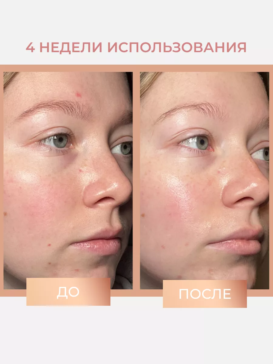 Сыворотка для лица увлажняющая ночная Miracle Night Serum REVOLUTION PRO  купить по цене 2 160 ₽ в интернет-магазине Wildberries | 217856130